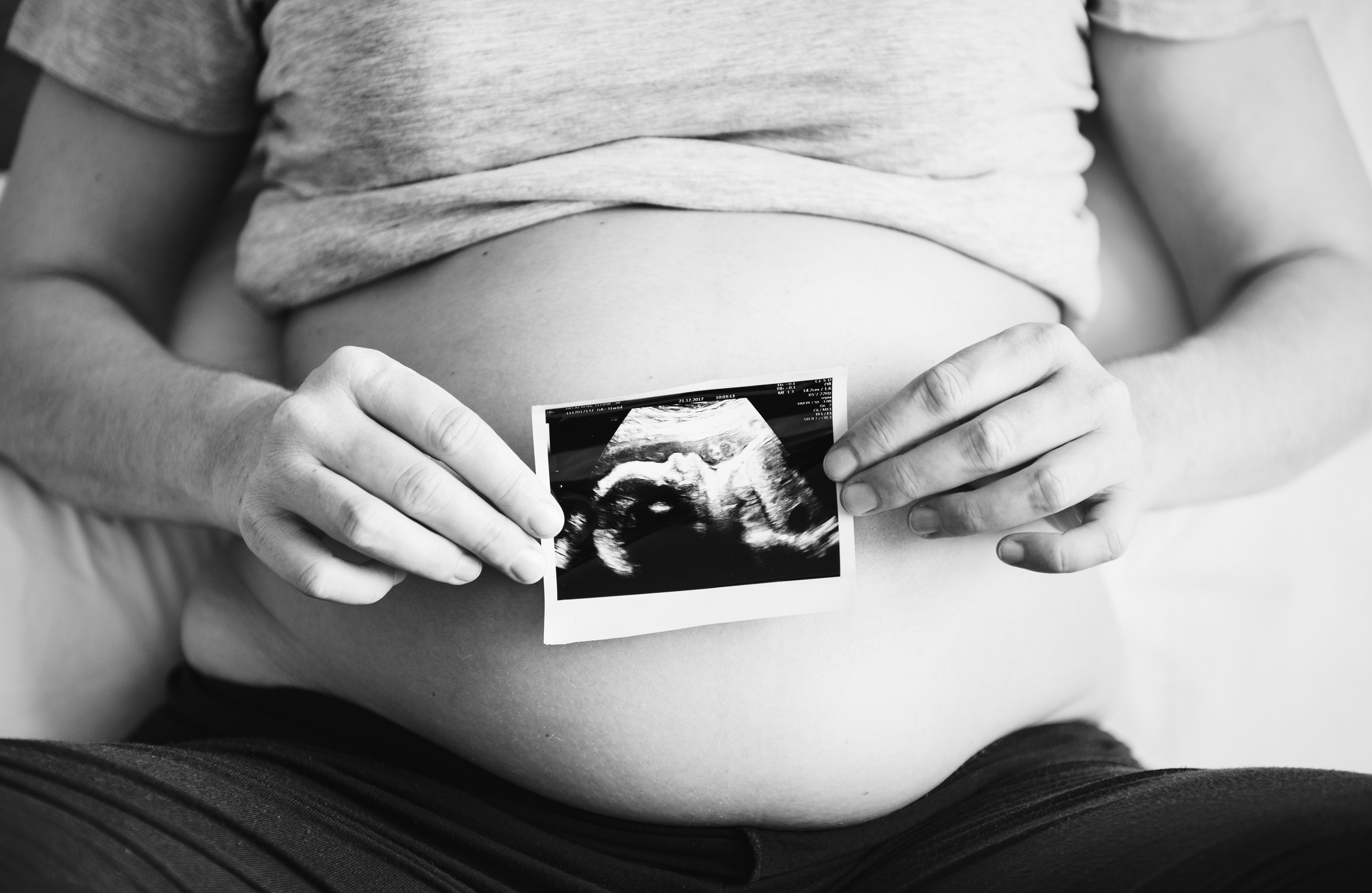 Image of Pregnant Woman Holding Ultrasound photo